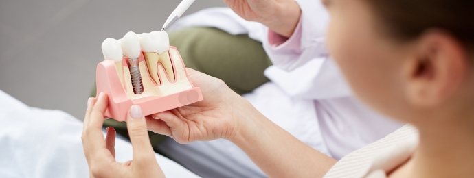 Implanty zębów Szczecin Dom Lekarski